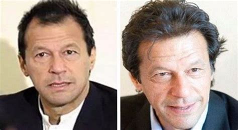 imran khan hair transplant