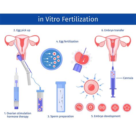 in vitro fertilization ivf adalah