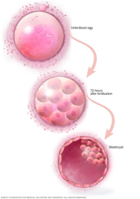 in vitro fertilization mayo clinic