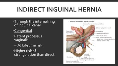 incarcerated left inguinal hernia indirect