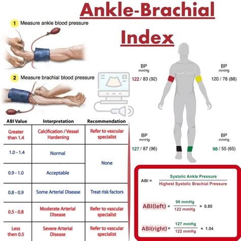 Index Procedure Meaning