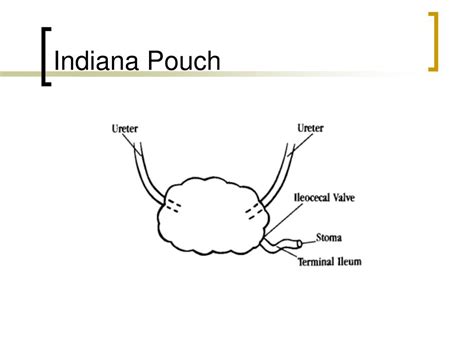 Indiana Pouch Problems