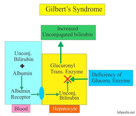 indirect bilirubin gilbert's syndrome
