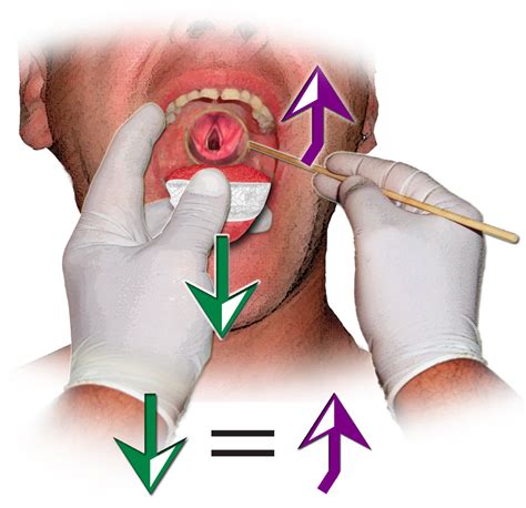 Indirect Laryngoscopy Cpt Code
