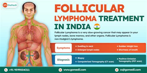 indolent follicular lymphoma symptoms