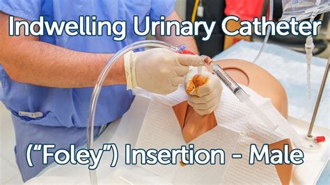 indwelling foley catheter care for men