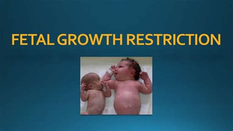 Understanding Infant Growth Restriction: Causes and Developmental Impacts
