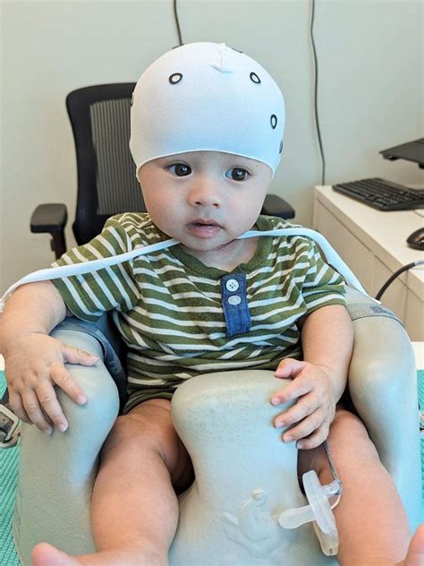 Infant Helmet Head Shape