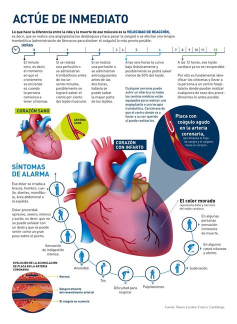 infarto del miocardio pdf