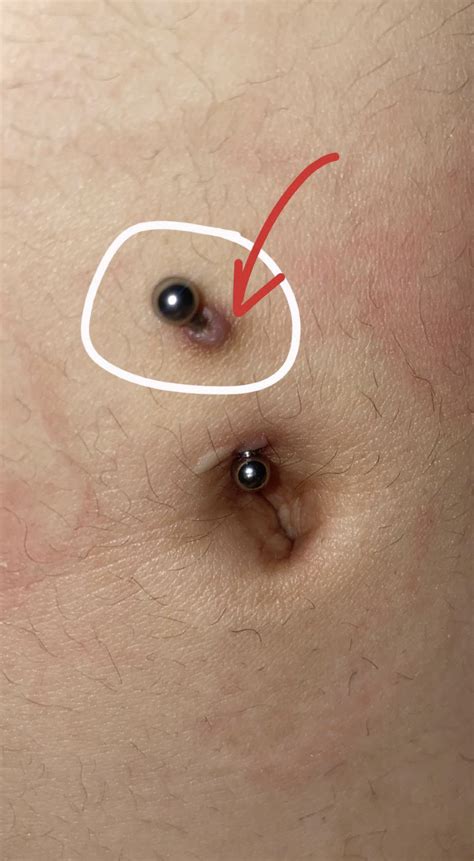 Warning Signs of an Infected Belly Piercing: What You Need to Know