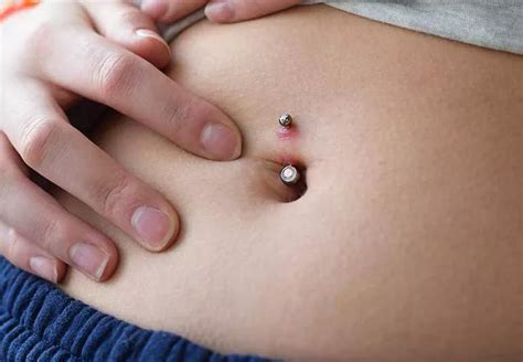 Warning Signs of an Infected Piercing Belly Button