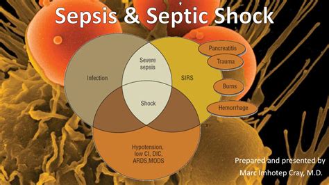 infection sepsis and septic shock