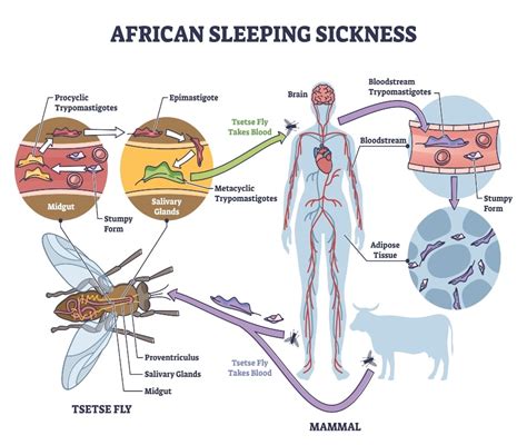 infezione malattia del sonno