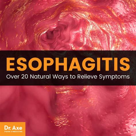inflamed esophagus natural treatment