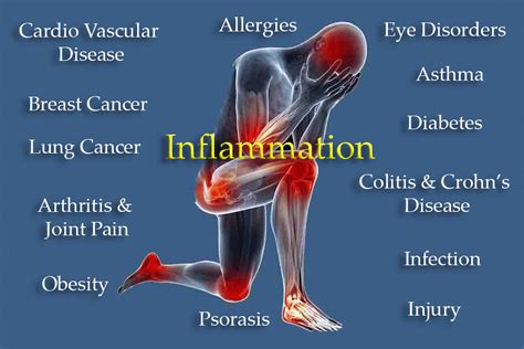 Reducing inflammation