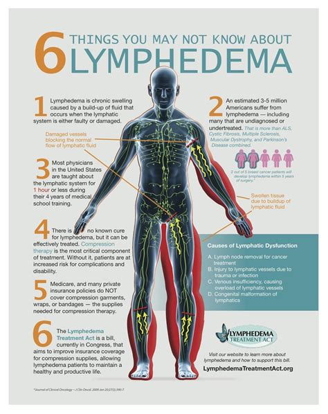 inflammation de la lymphe