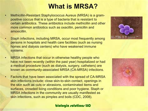 info on mrsa staph infection