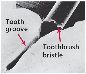 information about the bristle