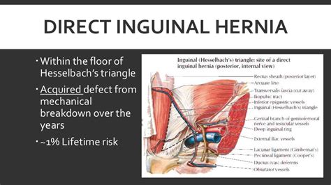 inguinal canal and hernia slide share