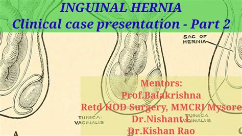inguinal hernia case presentation