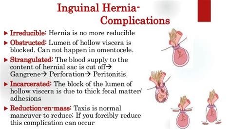 inguinal hernia not reducible