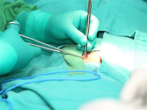 inguinal hernia surgery laparoscopic vs open