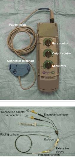 initial impulse setting for transcutaneous pacemaker