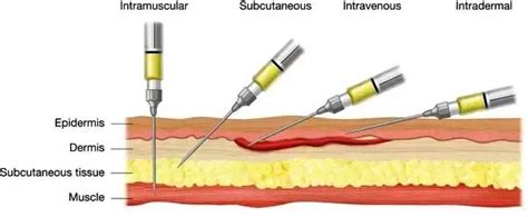 injection inject method