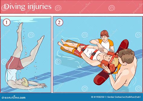 Injuries From Diving Board