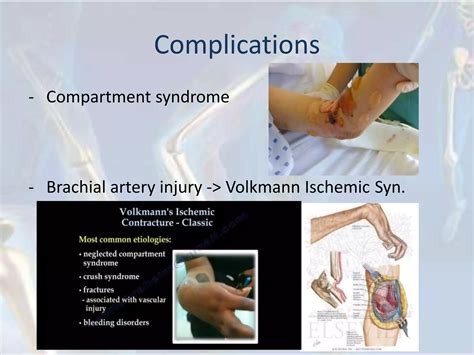 Painful Encounters: An Exploration of Sports Injuries