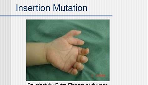Insertion Mutation Diseases List Of CBS s Download Table