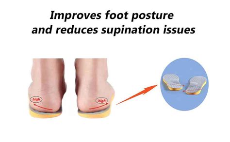 Insoles For Supination Correction