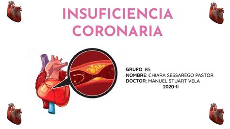 insuficiencia coronaria cie 10