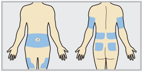 Insulin Injection Bumps