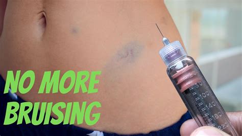 Insulin Shot Hurts