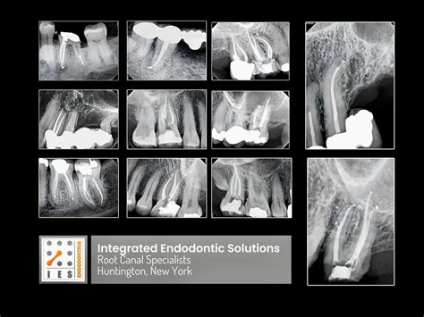 Integrated Endodontic Solutions