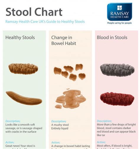 Internal Hemorrhoids Poop Shape