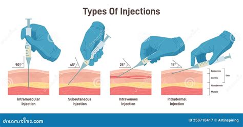 internal injections 2