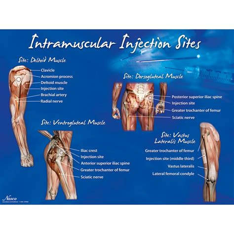 Mastering the Technique: A Guide to Safe and Effective Intramuscular Site Injection