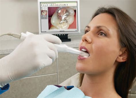 Intraoral Camera For Dentistry