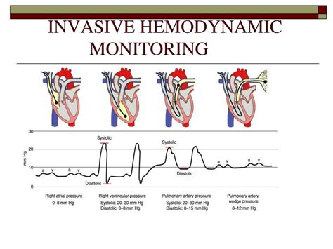 Invasive Monitoring Slideshare