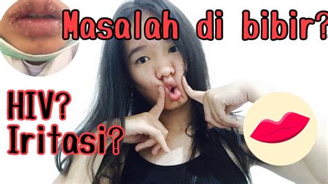 iritasi bibir