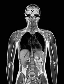 Subject Irm Du Corps Entier Update