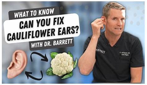 When Is It Too Late To Drain Cauliflower Ear - Best Drain Photos