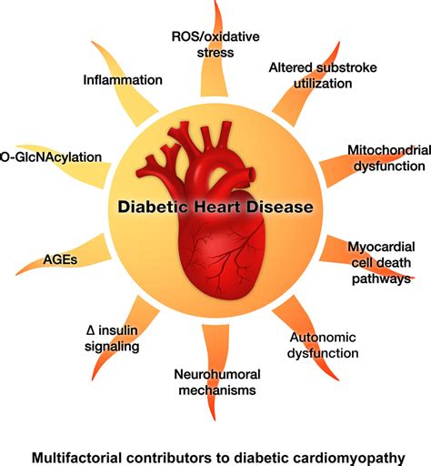 is diabetes cardiovascular disease
