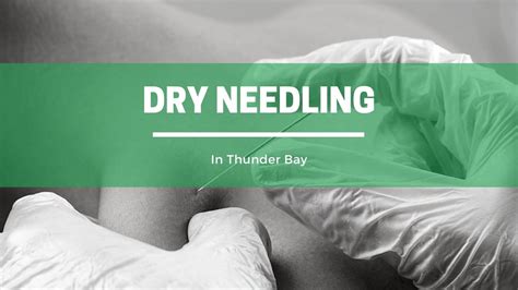 Is Dry Needling Covered By Insurance?