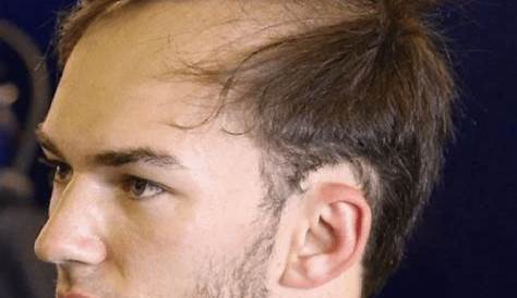 Is Pierre Gasly Bald? Unraveling The Mystery Behind His Close-Cropped Hairstyle