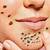 is popping blackheads bad for your skin