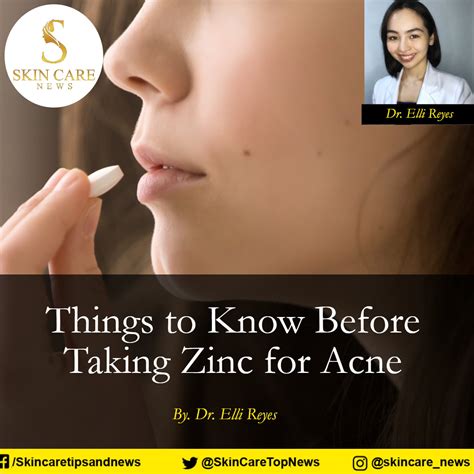 is zinc good for acne