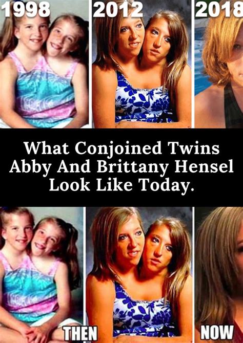 is abby and brittany hensel pregnant